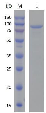 15% SDS-PAGE analysis profiles of purified MCR_RS03140-21-708 (CBB stained).